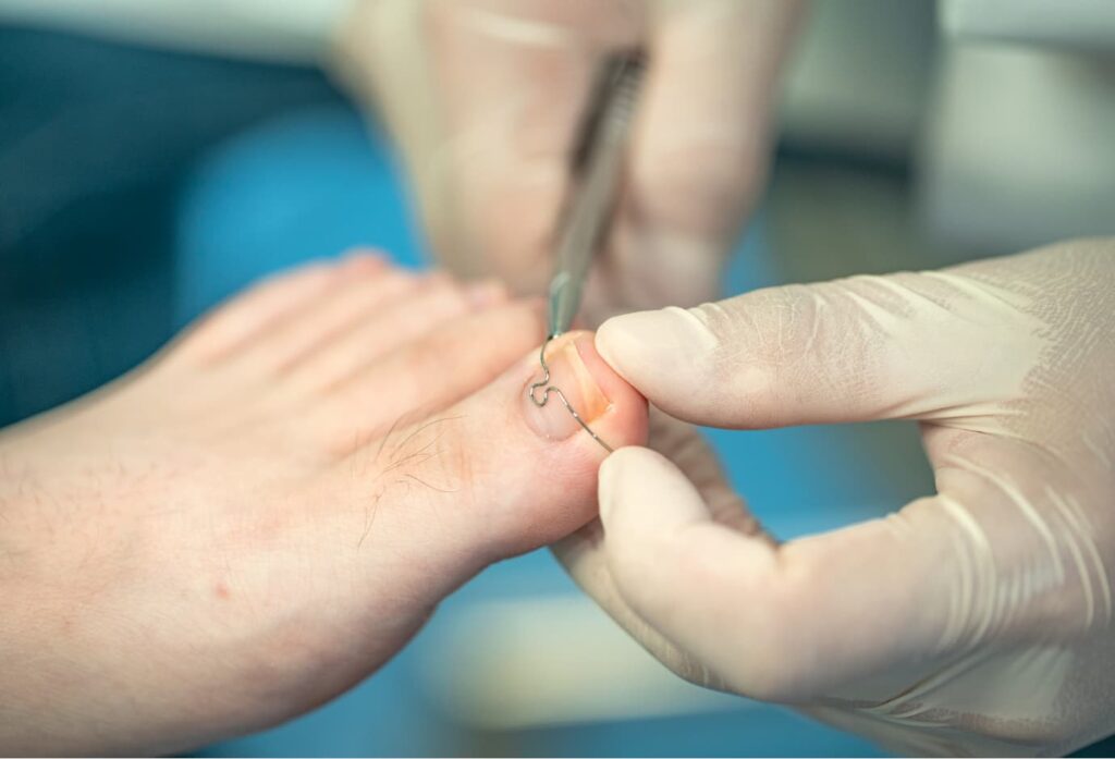 Podologia na Fisiosolutions